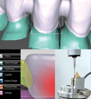 3次元CAD/CAMシステム