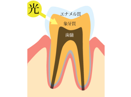 天然歯に近い人工歯