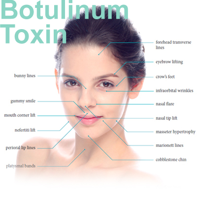 ボツリヌストキシン治療