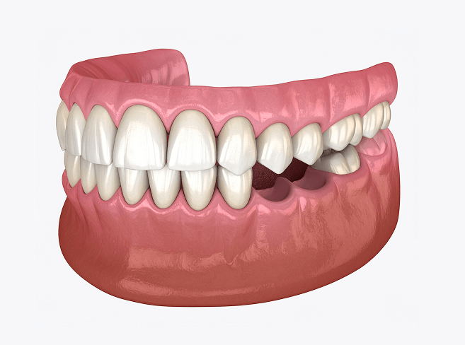 先天性欠損イメージ