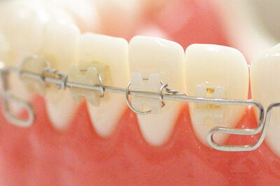 プラスチック・セラミック製