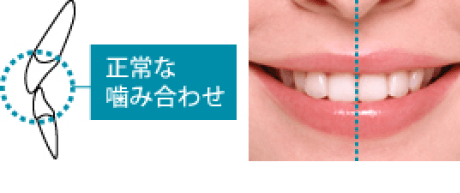 「キレイな歯並び」とは？