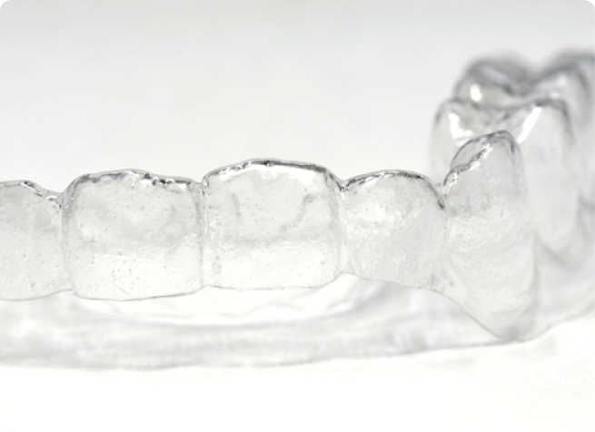 マウスピース矯正イメージ