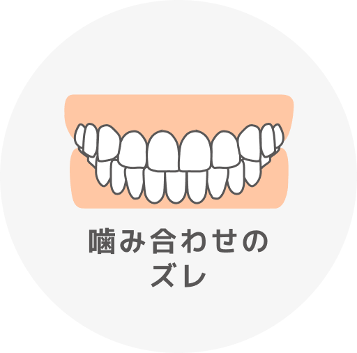 噛み合わせが深い