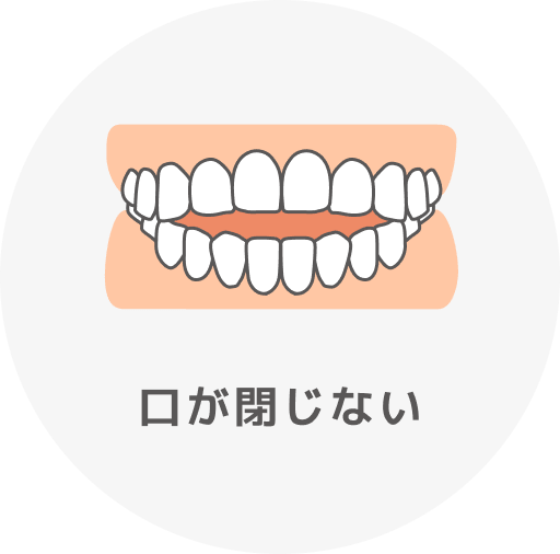 口が閉じない
