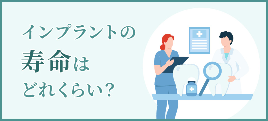 インプラントの寿命はどれくらい？