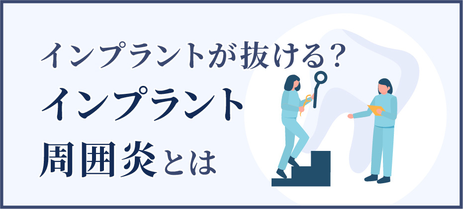 インプラントが抜ける？インプラント周囲炎とは