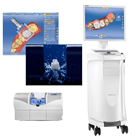 インプラント治療