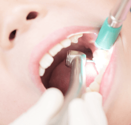 CFOOと連携した矯正治療