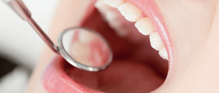 先天性欠損アプローチ