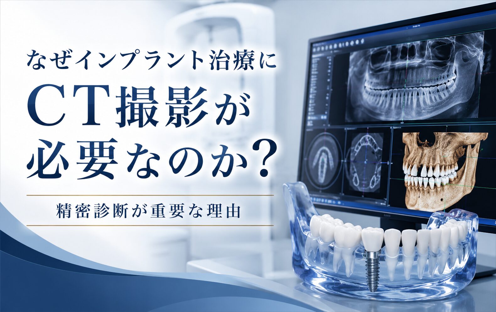 なぜインプラント治療にCT撮影が必要なのか