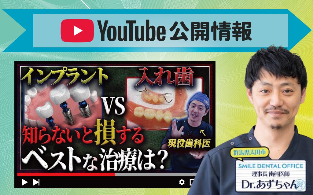 インプラントと入れ歯の違い