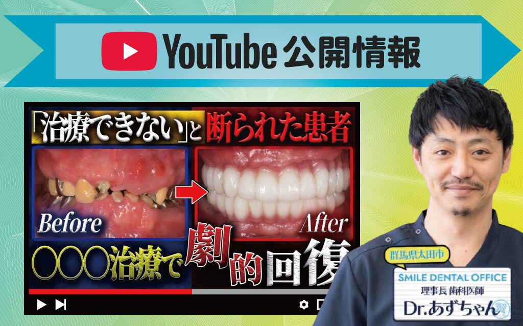 他院で治療を断られた患者の劇的ビフォーアフターを解説!【インプラント】