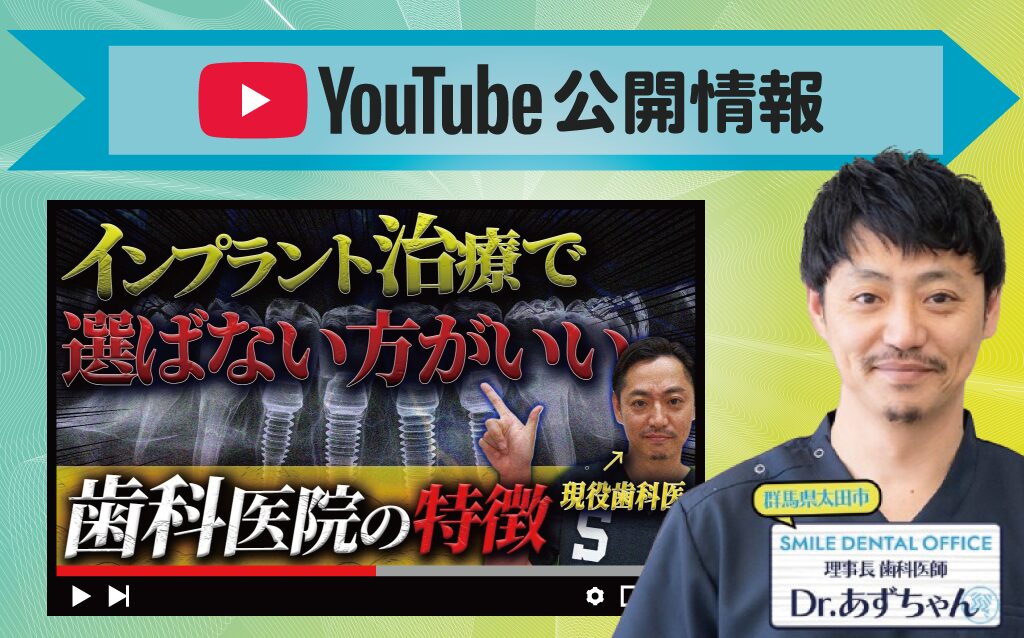 【YouTube動画】インプラント治療で絶対選ばない方が良い歯科医院の特徴を現役歯科医が暴露します