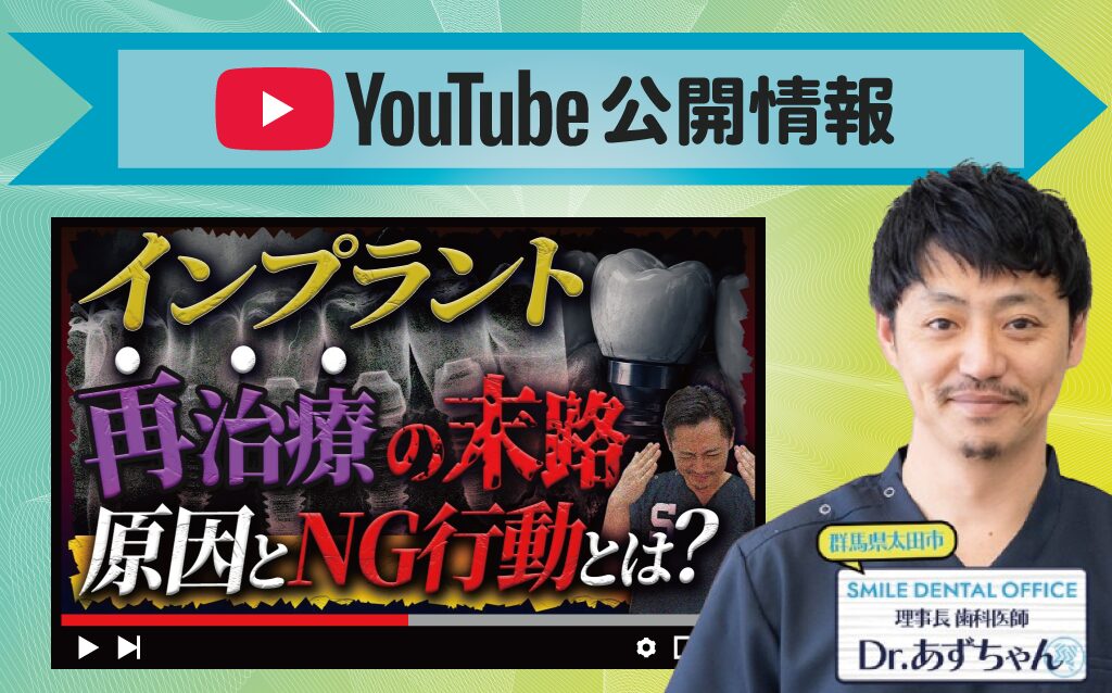 【YouTube】当院は他院で断られたインプラント治療が可能