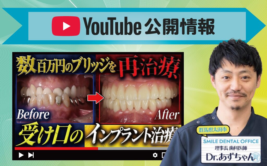 【YouTube】格安インプラントは安全?歯科医院選びの注意点