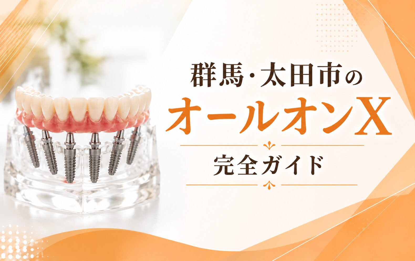 群馬・太田市のオールオンX完全ガイド