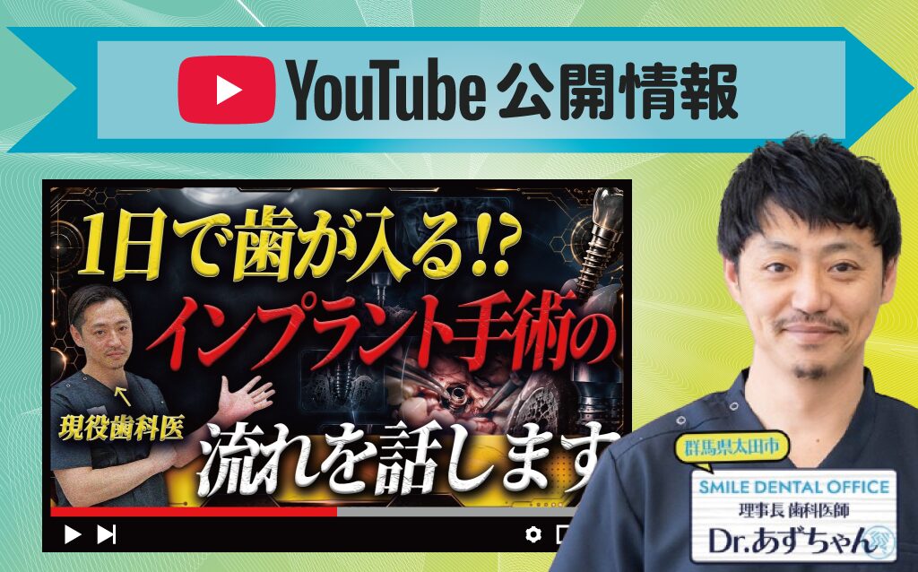 【YouTube】インプラントの診断から手術後までの流れを解説