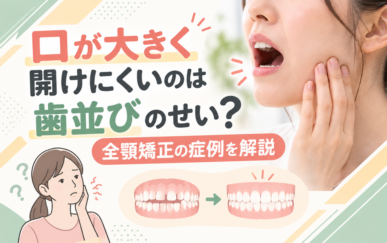 口が大きく開けにくいのは歯並びのせい？全顎矯正の症例を解説