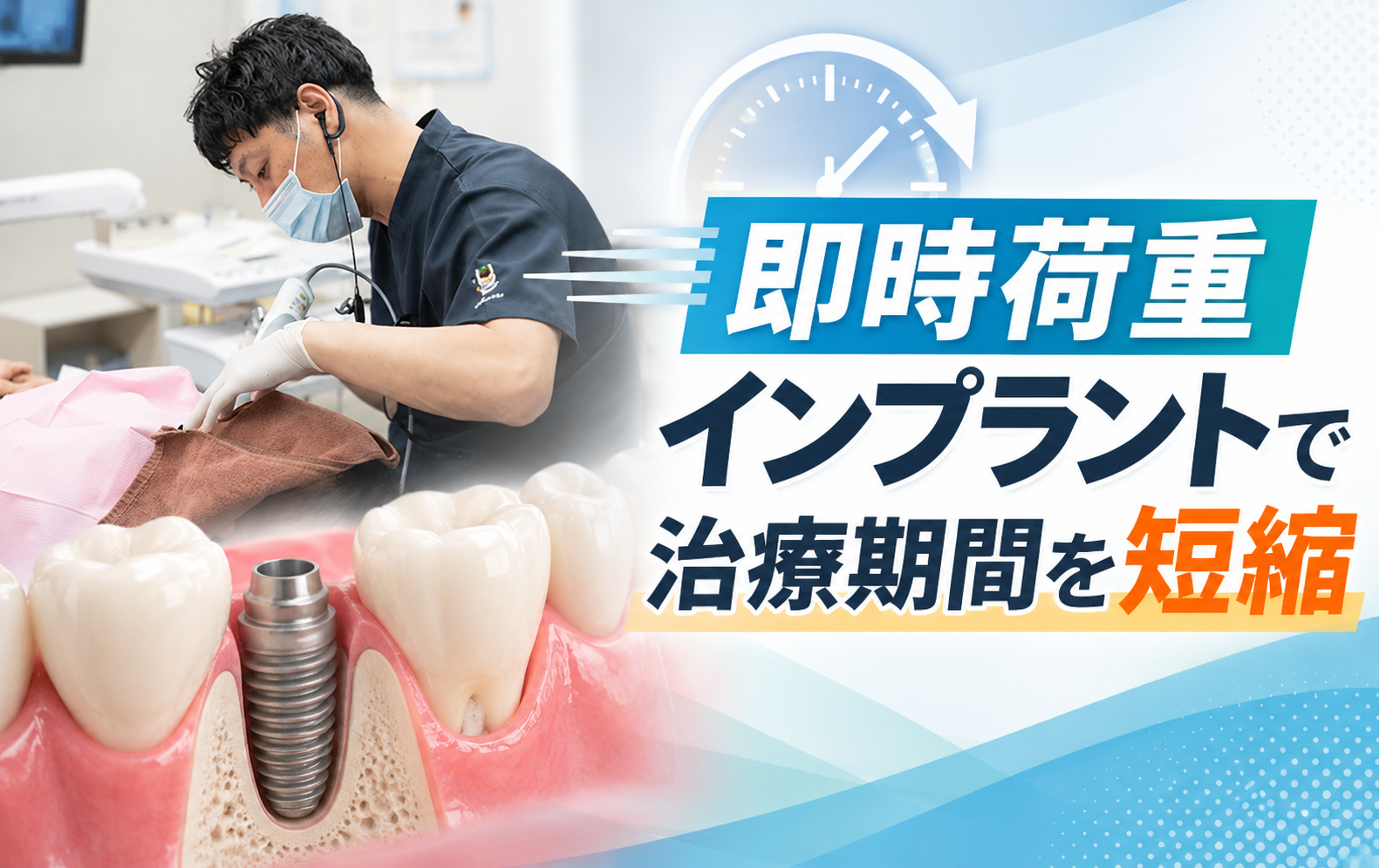 即時荷重インプラントで治療期間を短縮