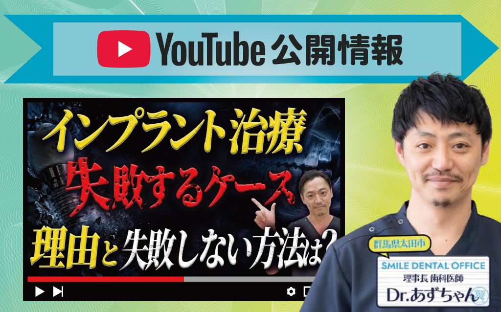 【YouTube】インプラント治療で失敗しやすい3つのケースと対策